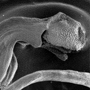 Anzybas aff. unguiculatus, column, lateral sepal and petal from side, Angelsea, VIC