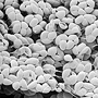 Arthrochilus rosulatus, pollen tetrads, Cooktown, QLD