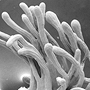 Arthrochilus irritabilis, callus glands, Cape Hillsborough, QLD