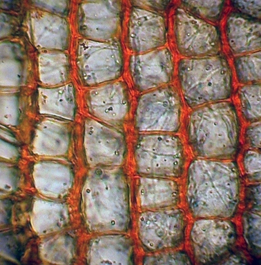 APII jpeg image of Warburgiella leucocytus  © contact APII