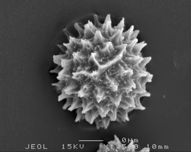 APII jpeg image of Fossombronia spiny 1'  © contact APII