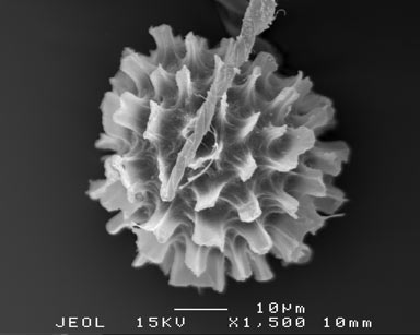 APII jpeg image of Fossombronia cultriformis  © contact APII