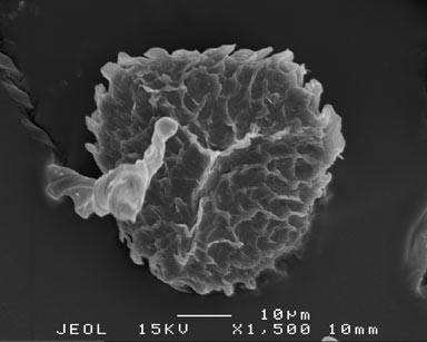 APII jpeg image of Fossombronia purpureospora  © contact APII