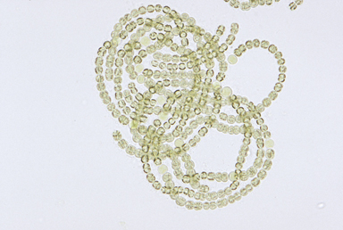 APII jpeg image of Anabaena spiralis  © contact APII