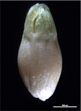 APII jpeg image of Scleranthus biflorus  © contact APII